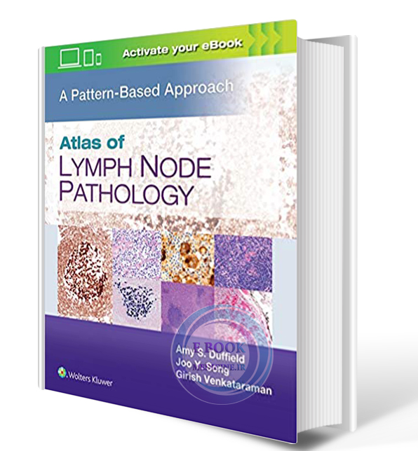 دانلود کتاب Atlas of Lymph Node Pathology: A Pattern Based Approach2021( PDF)